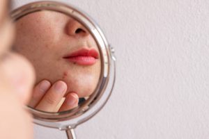 Hati-Hati, Inilah Kebiasaan Penyebab Skin Barriermu Rusak