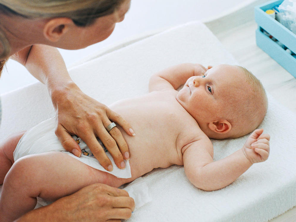 Cara Mencegah Ruam Popok Bayi Secara Alami